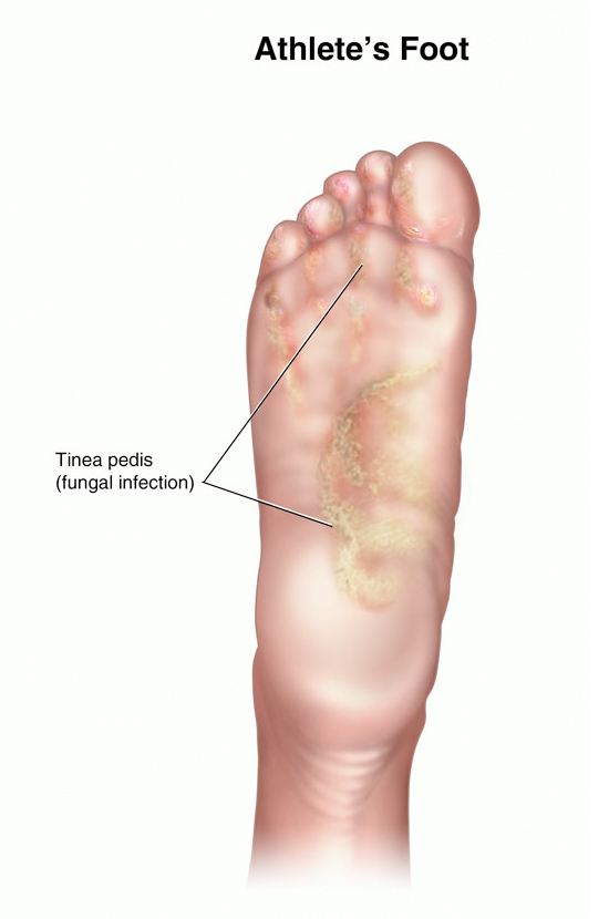 itchy dry skin on bottom of foot